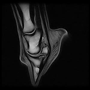 FootCT