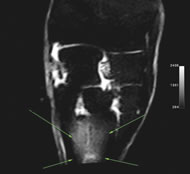 Typical Equine Limb Case Study of Carpus