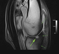 Typical Equine Limb Case Study of Fetlock