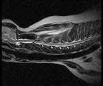 FSE-T2-REL-Sag-cervical-sm
