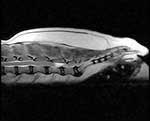 FSE-T2-REL-sag-lumbar-sm