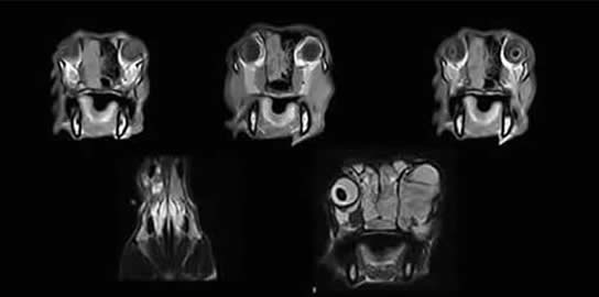 Neoplasia Example A