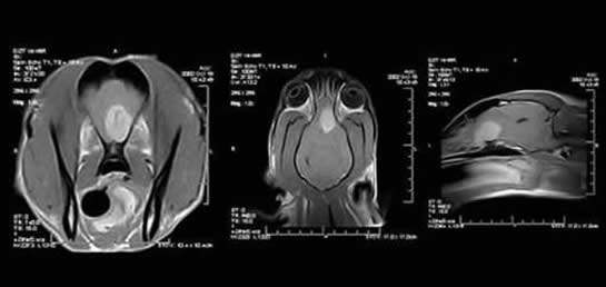 Neoplasia Example B