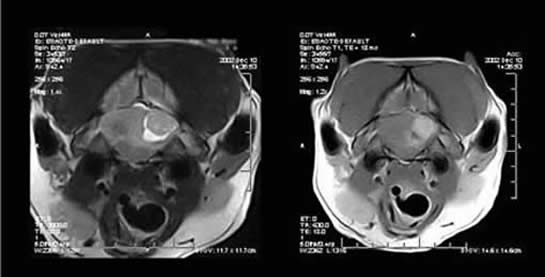 Neoplasia Example D